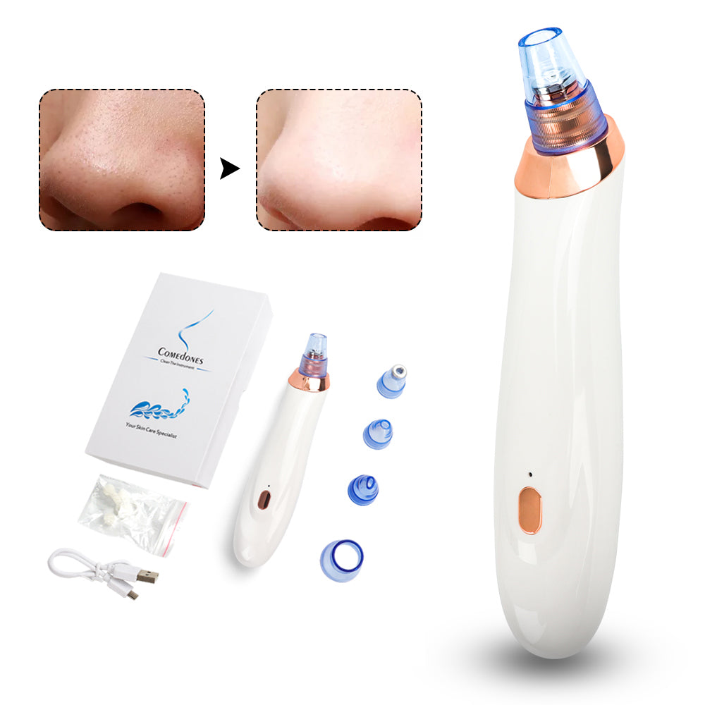 Electric Blackhead Remover